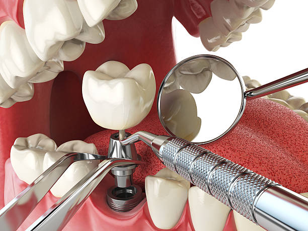 Best Weekend Emergency Dentist in Wooster, OH